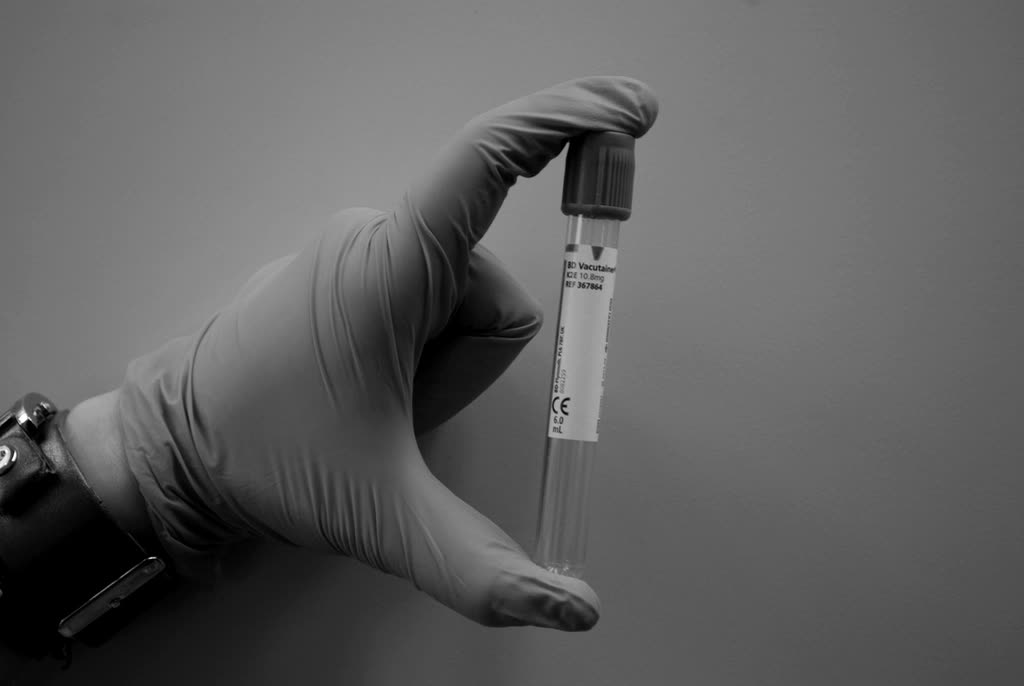 A gloved hand holding a labelled blood collection tube.